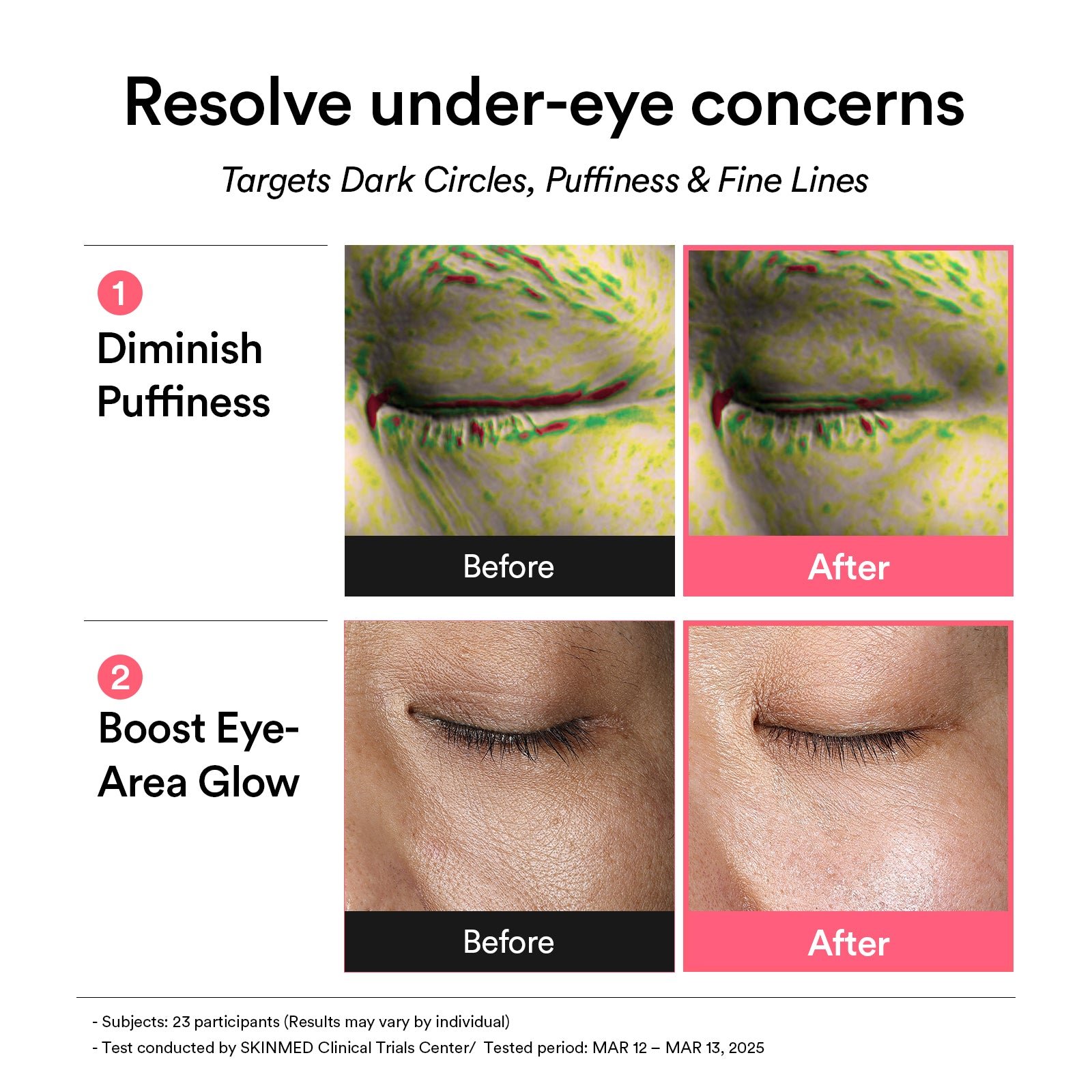 Complete Glow Trio