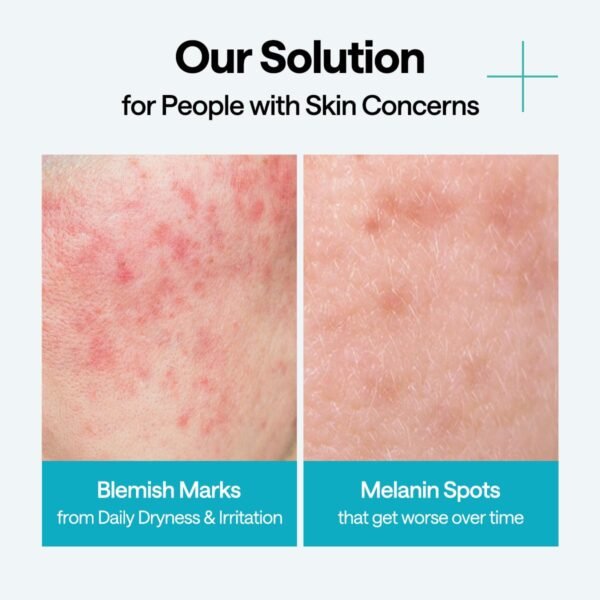 Madecassoside Wrapping Serum Mask