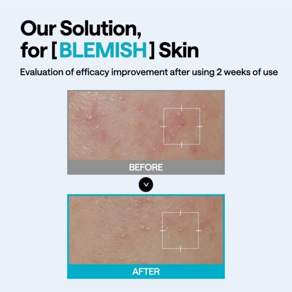 Madecassoside Wrapping Serum Mask