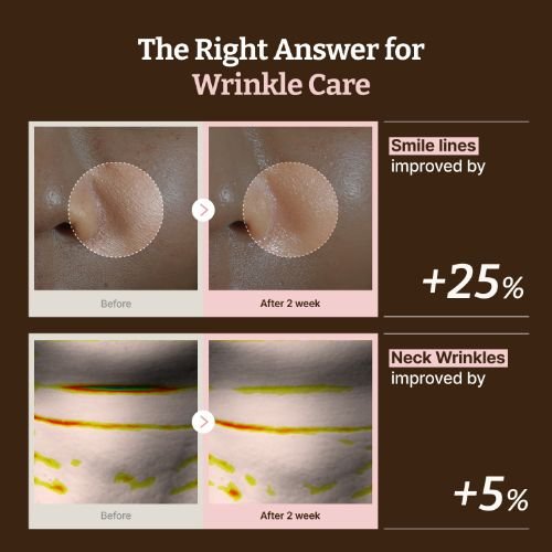 Advanced PDRN Rejuvenating Mask (4ea) - Gallery image 2