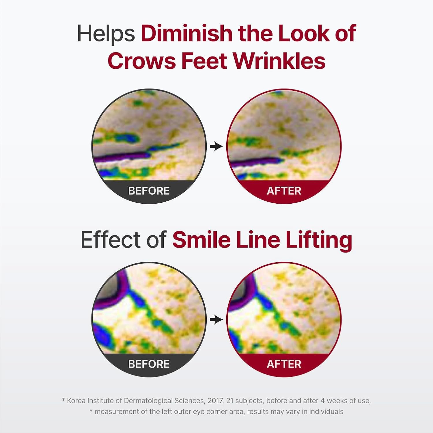 Madeca Derma Mask III Intensive Formula (10pcs) - Detail image 3