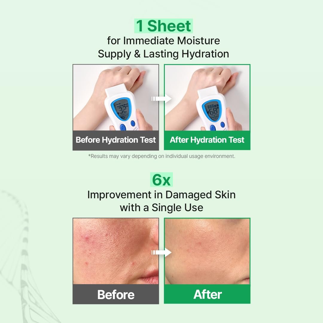 EGF Skin Barrier Dressing Mask Pack 23ml (1ea) - Gallery image 4