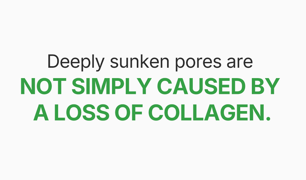 *renew* Green Tomato NMN Pore Lifting Ampoule Mask (1ea) - Detail image 18